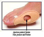 Bunion Shield Universal